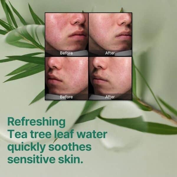 Some By Mi AHA BHA PHA 30 Days Miracle Cream | 60ml | Made From Tea